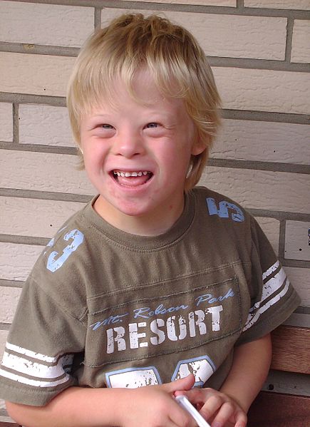 Fichier:Boy with Down Syndrome.jpg