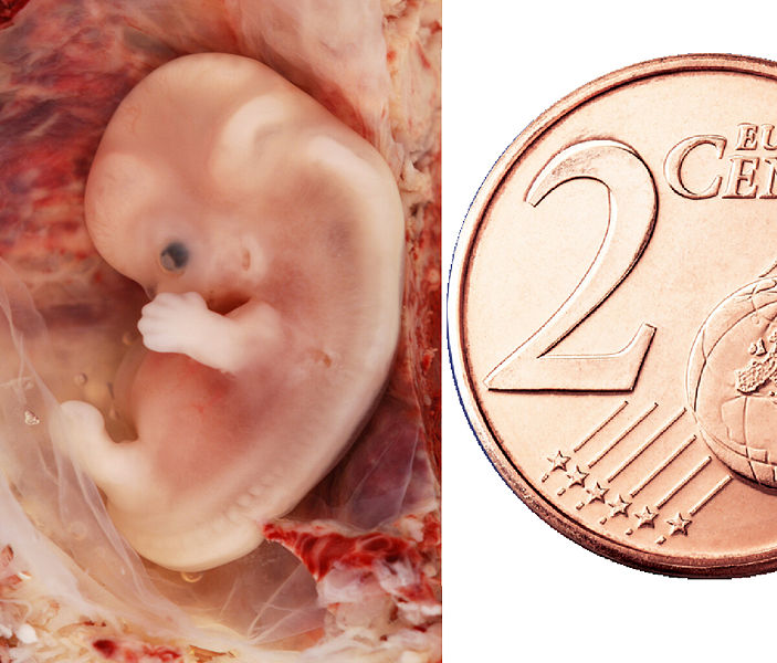 Fichier:Embryo 9 Wochen mit Groessenvergleich3.JPG