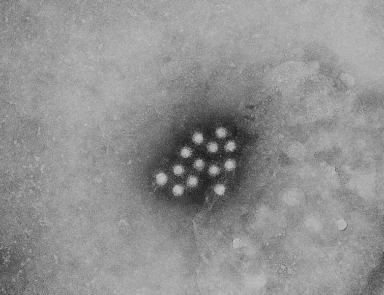 Fichier:Hepatitis A virus 01.jpg