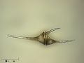 Un dinophyte : Ceratium hirundinella.