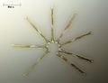 Une diatomée : Asterionella