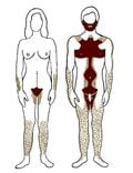 Répartition de la pilosité (des poils) chez la femme et l'homme adultes