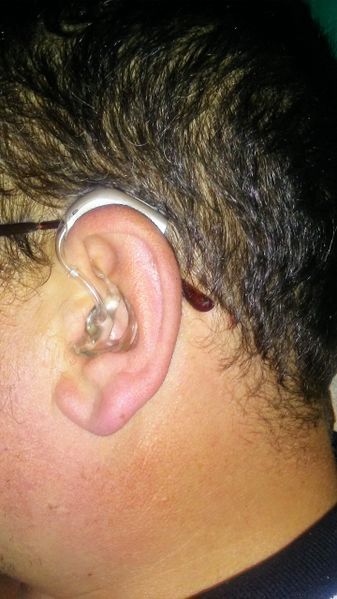 File:Hearing aid in use.jpg