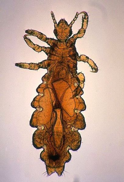 Fichier:Pediculus humanus var capitis female2.jpg