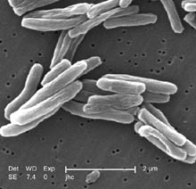 Fichier:Mycobacterium tuberculosis.jpg