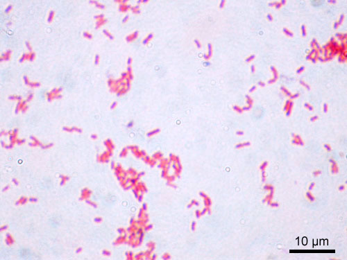 Fichier:Escherichia coli Gram.jpg