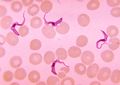 Un flagellé : le trypanosome