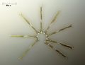 Une diatomée : Asterionella