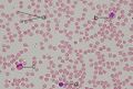 Frottis de sang humain, grossi environ 300x : a. Globules rouges ; b, c, d. Globules blancs