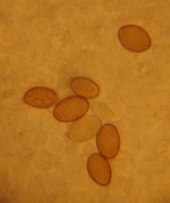 Agrocybe pediades spores.jpg